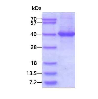 SDS-PAGE: Recombinant Human CRALBP His Protein [NBP2-51538]